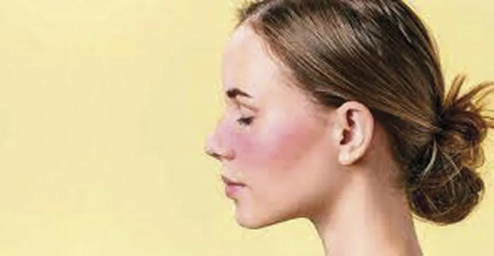 Doctor… ¡tengo la cara roja!