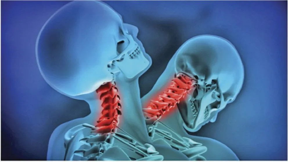 Síndrome del latigazo cervical