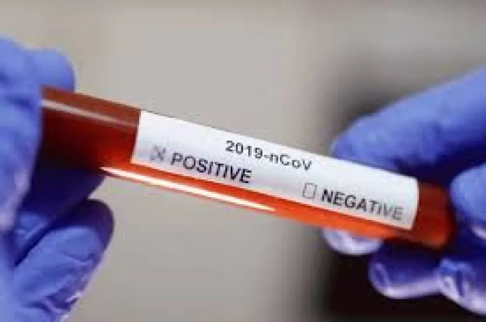 Argentina superó los 10 millones de contagios de coronavirus acumulados